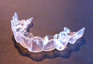 Invisalign aligner 300x206 - Orthodontie Enfant