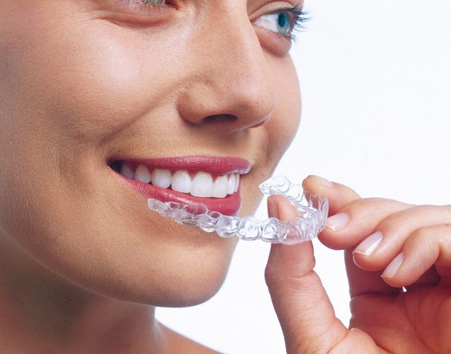 invisalign