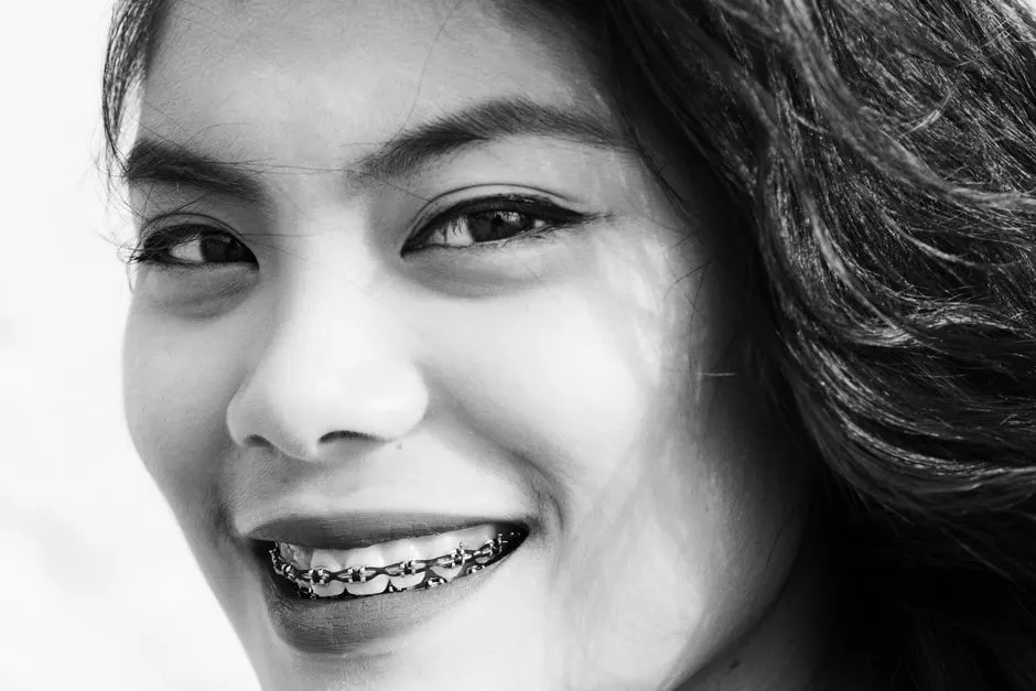 Orthodontie adulte : des dents mieux alignées en combien de temps, et pour quels bénéfices concrets