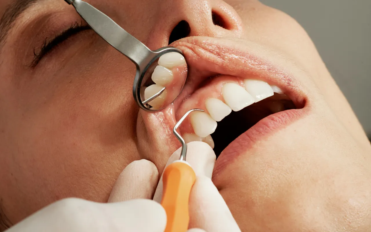 Non, le détartrage ne fragilise pas vos dents : idées reçues et réalité sur les risques et bénéfices pour la santé