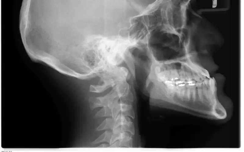 La malocclusion dentaire pèse sur la santé bien plus qu'on ne le croit